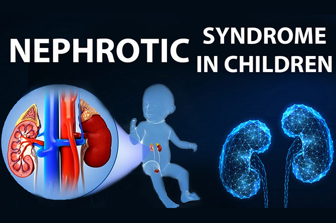 Pediatrics Nephrotic syndrome